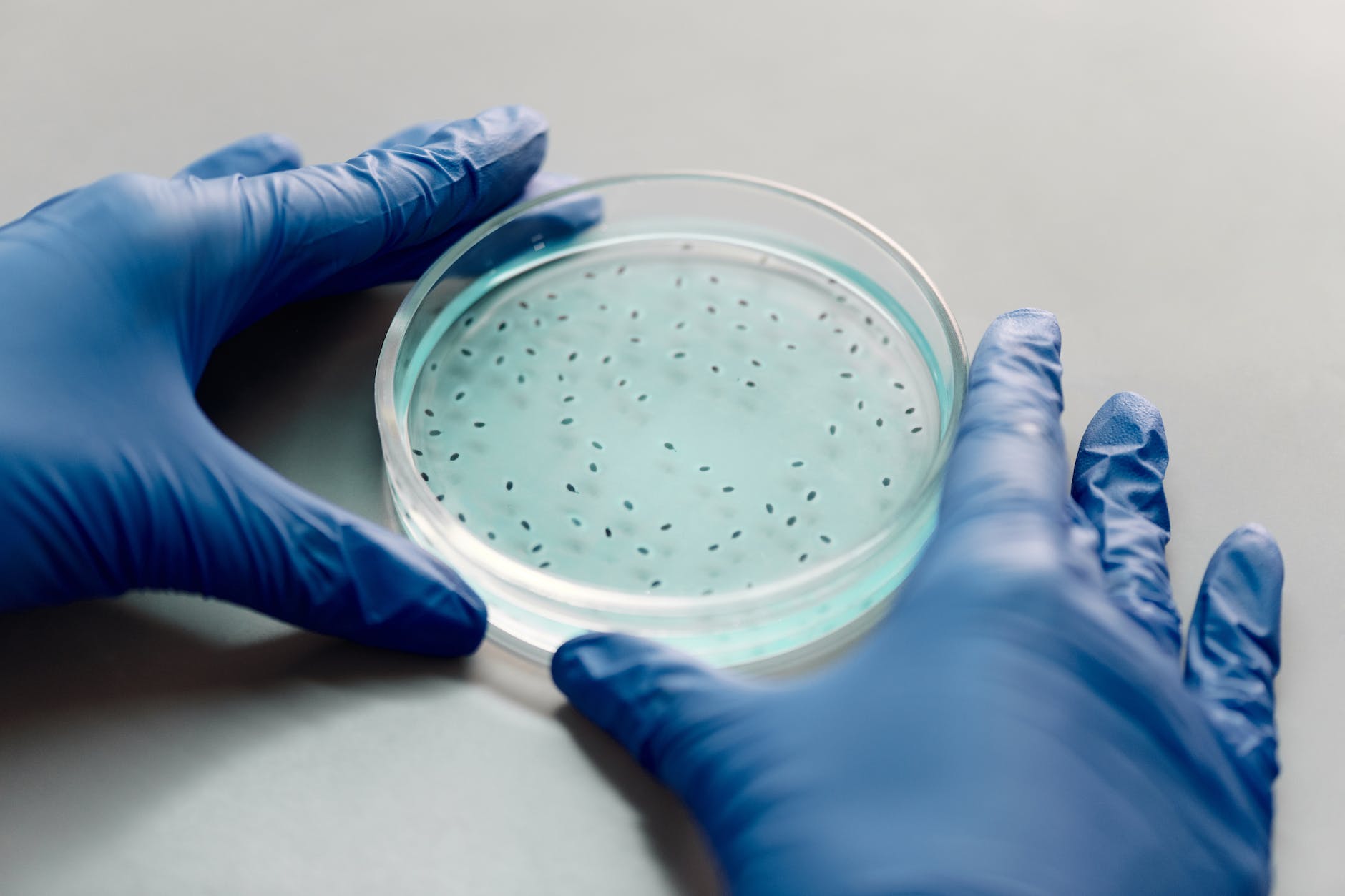 globed hands holding Petri dish with spots