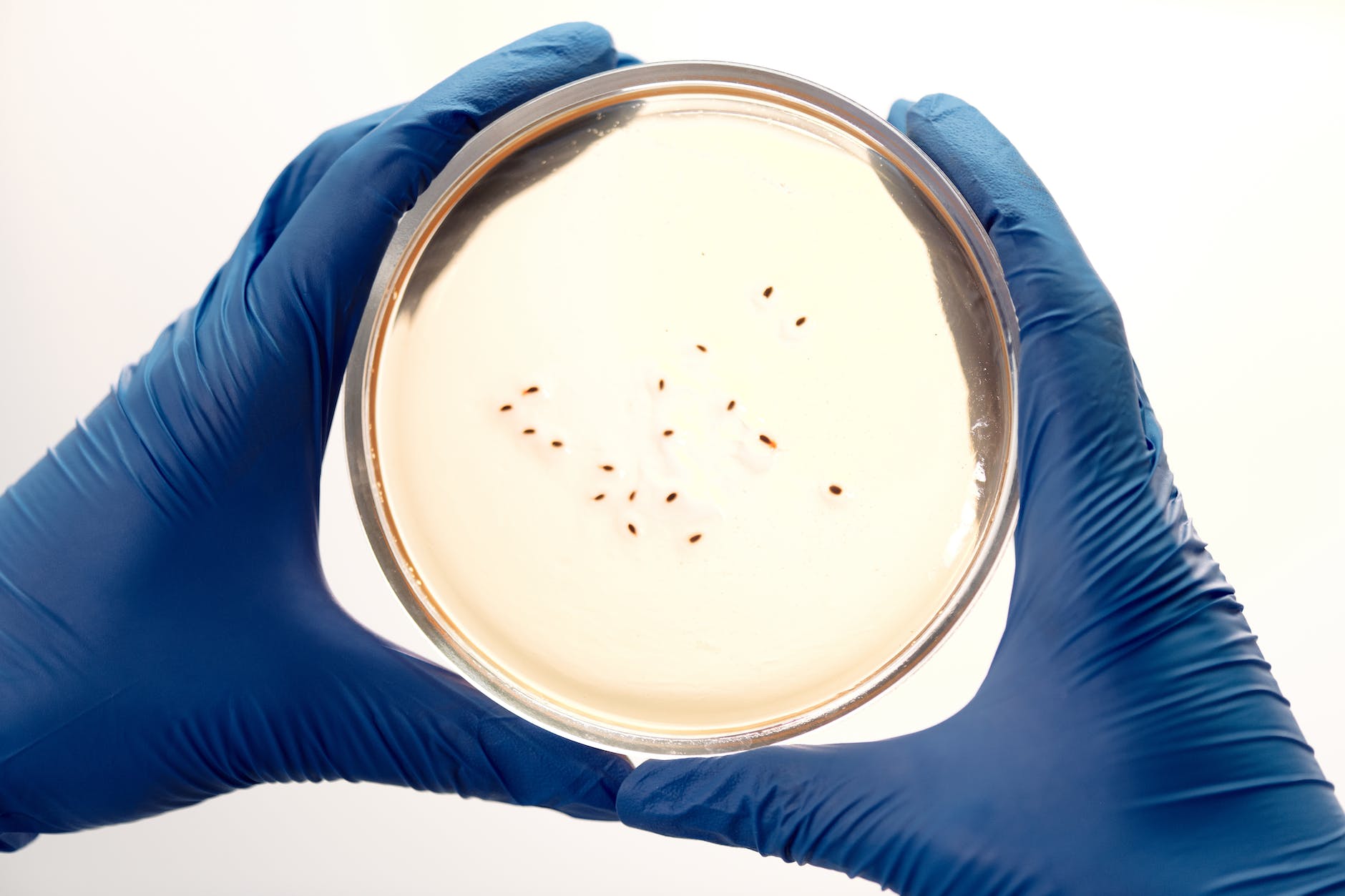 gloved hands holding Petri dish with colonies