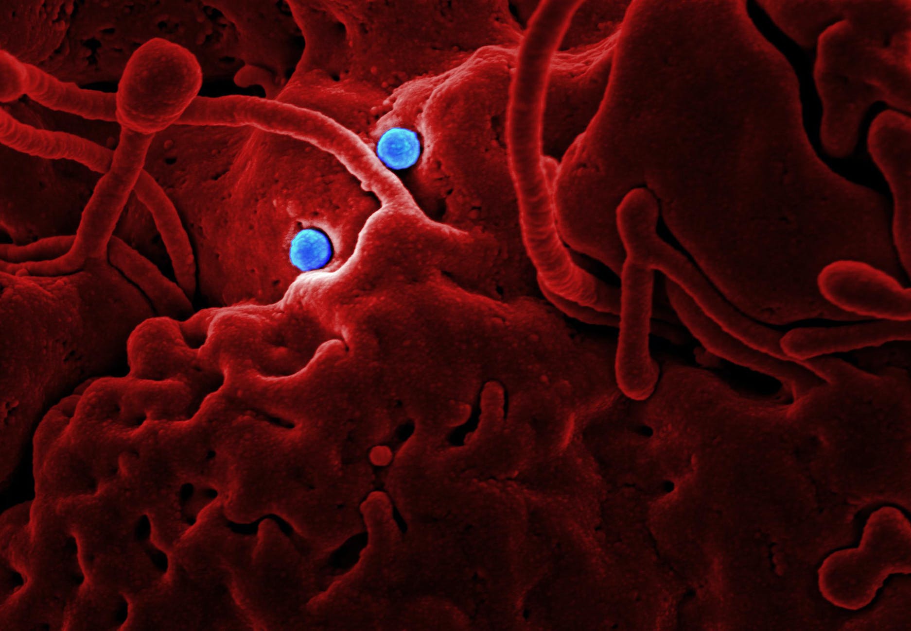 3D rendering of cells with red elongated filaments and blue spheres.