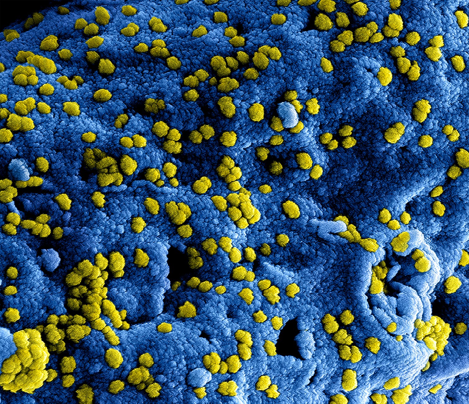 3D rendering of yellow bacteria on blue surface