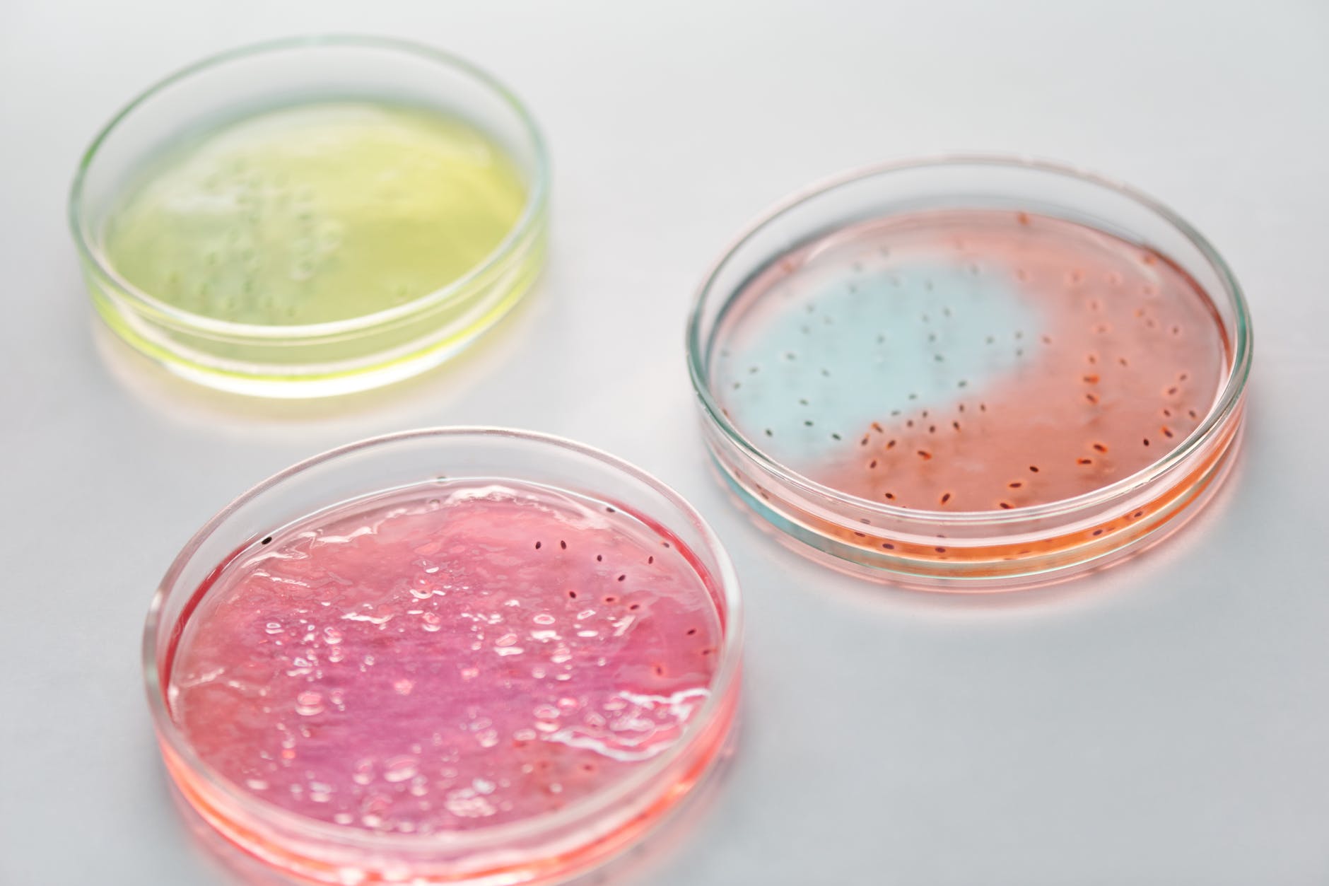 Three plates with different bacteria and colors: yellow, red, orange.