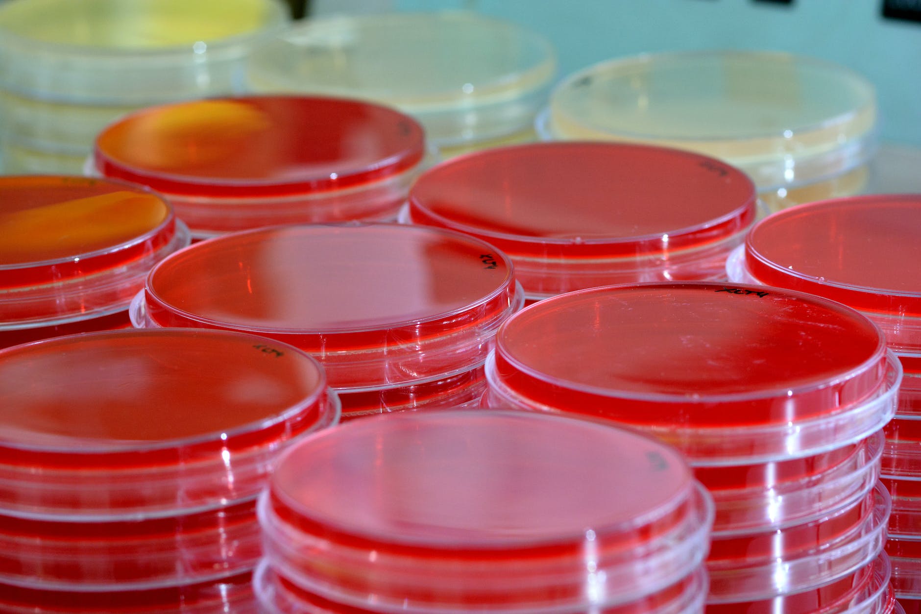 Stacks of red blood agar bacterial plates (agar side up)