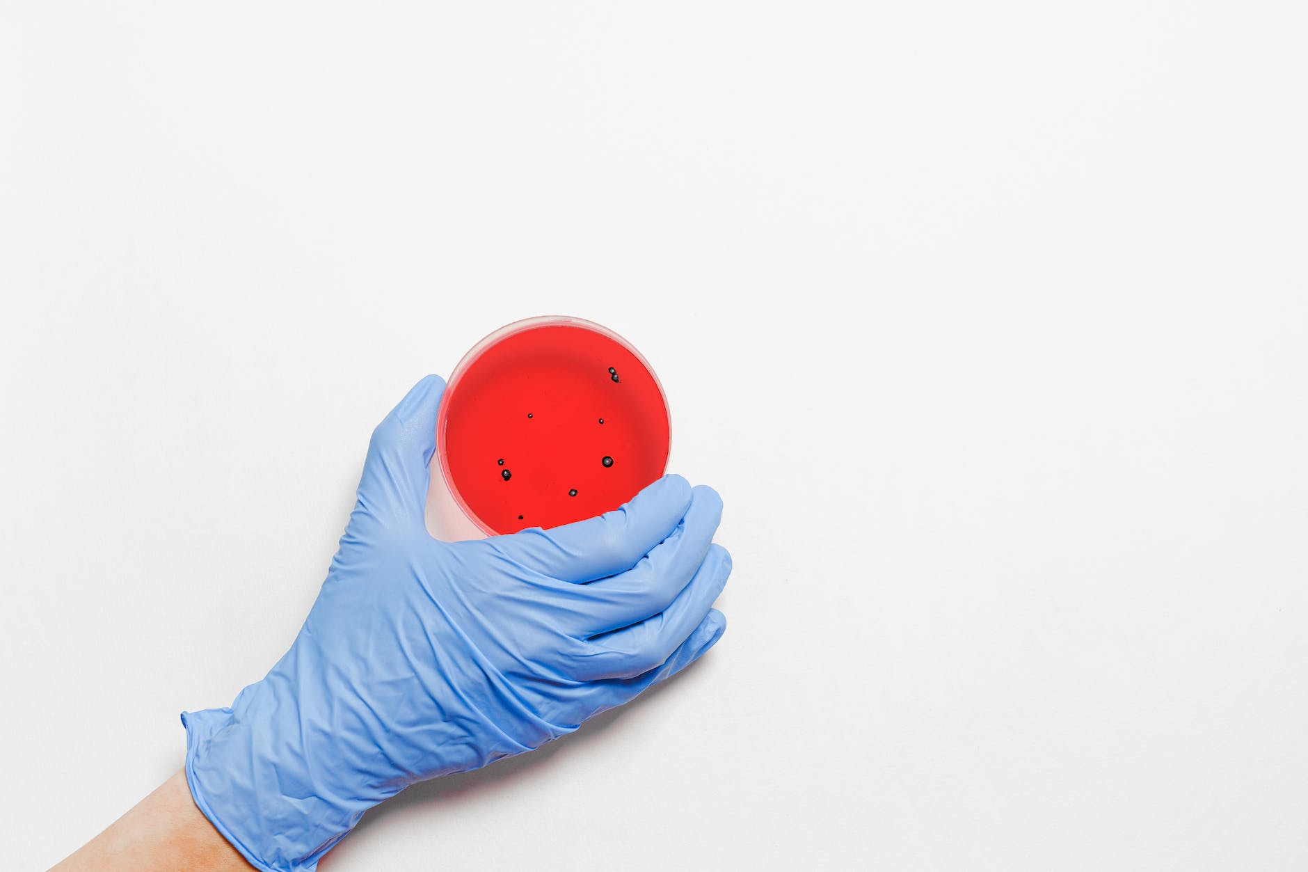 gloved hand holding red agar plate