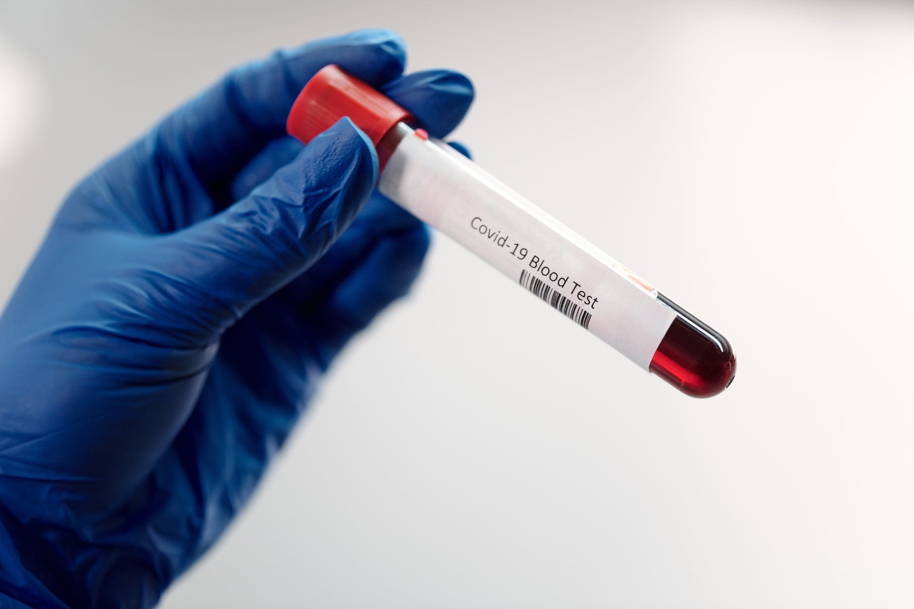 blood test vial labeled covid-19 blood test
