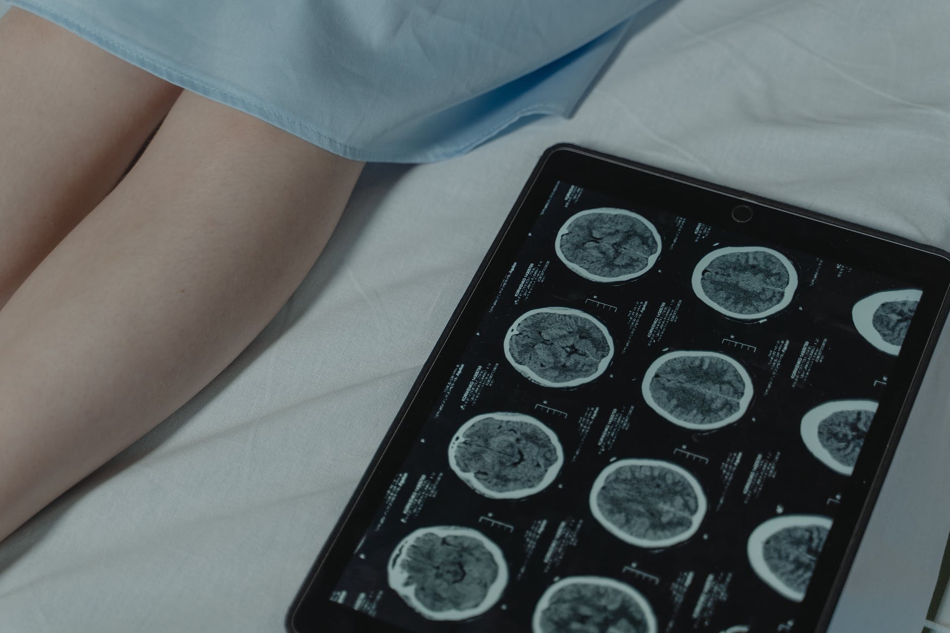 Ct scan result on digital tablet next to patient in bed