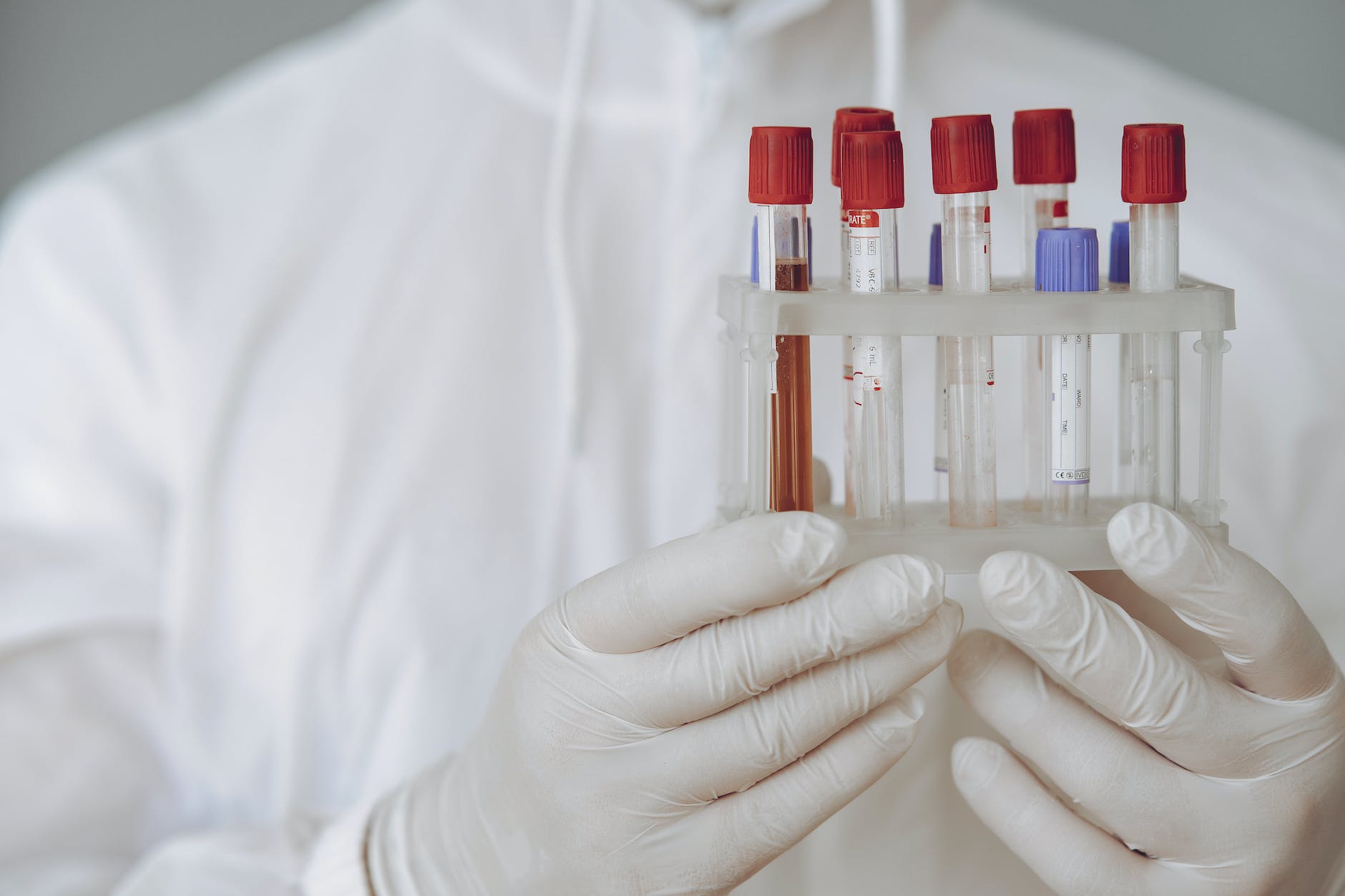 person holding test tube rack with red and purple caps