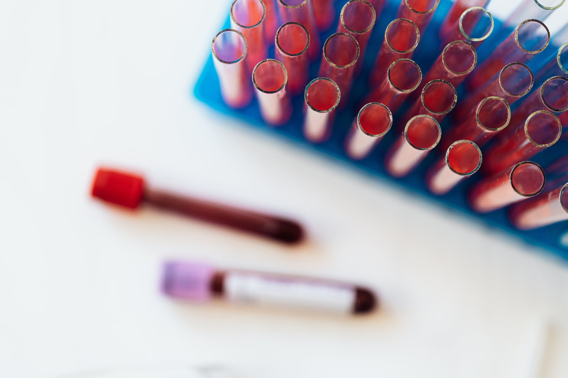 blurred top down photograph of rack of blood vials