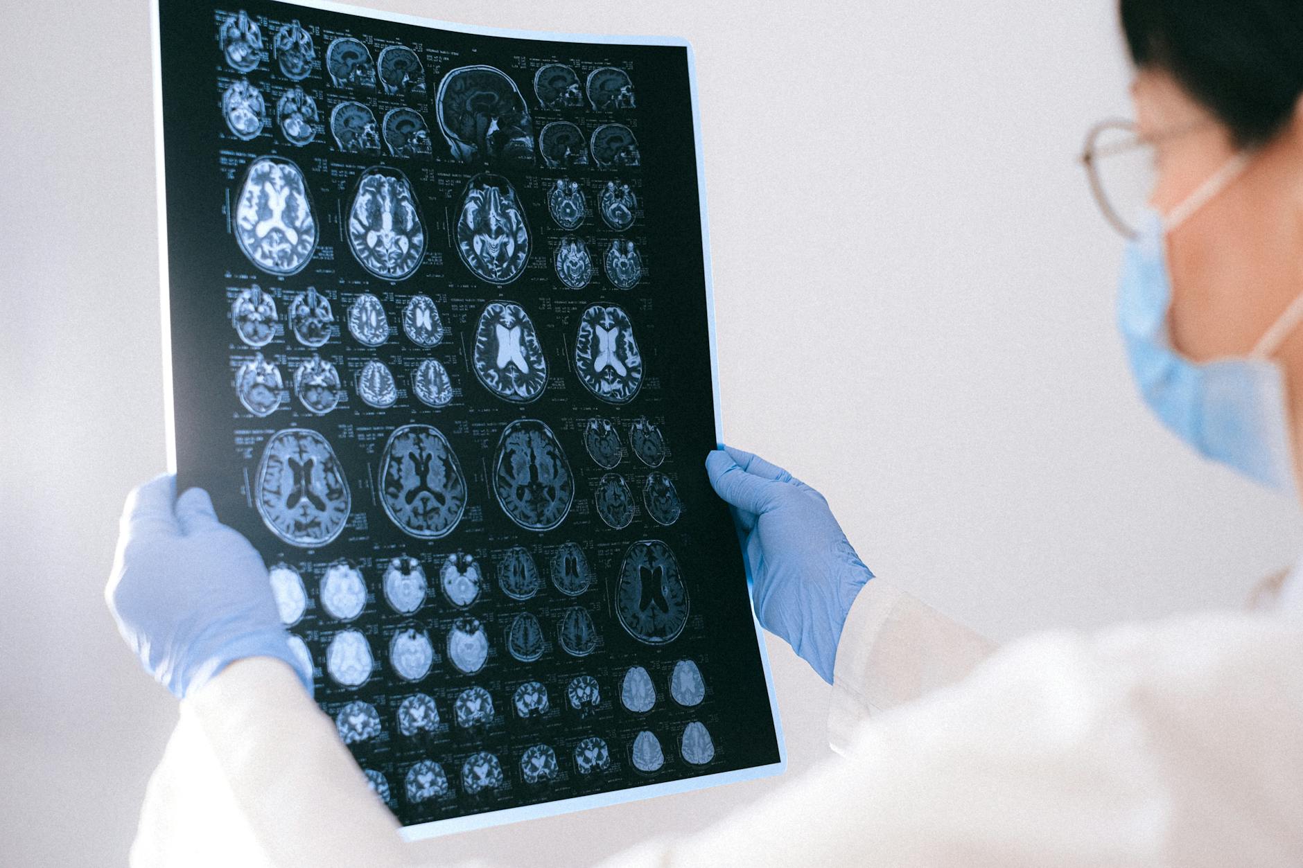doctor wearing mask holding brain scans